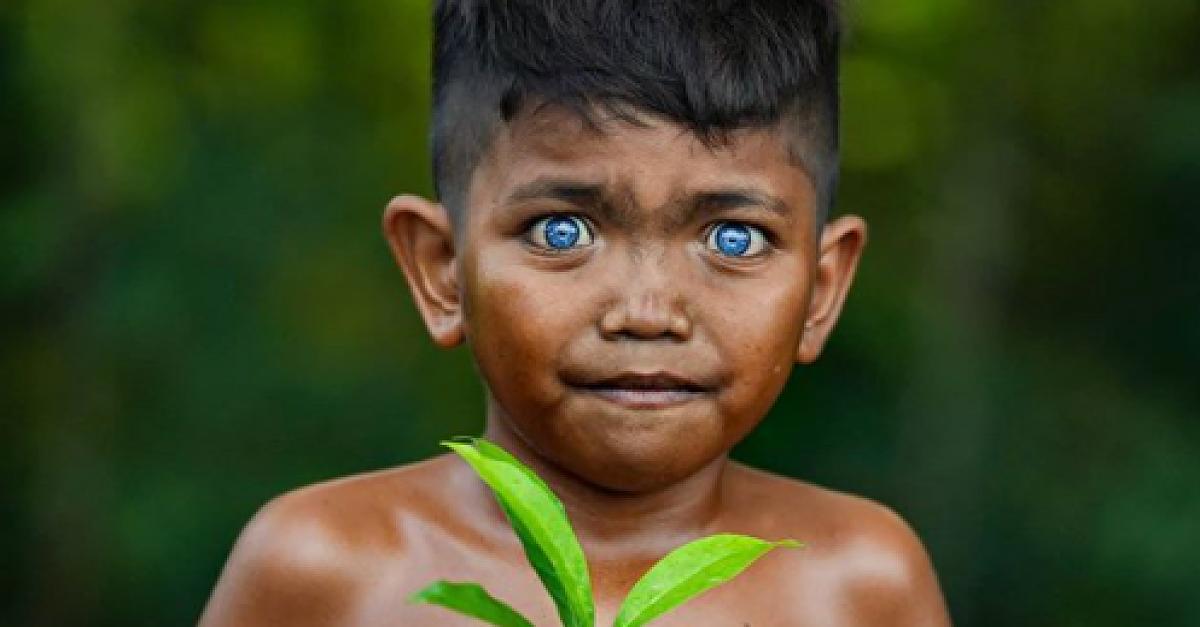 Mitglieder haben Waardenburg-Syndrom: Der Stamm mit den strahlend blauen Augen