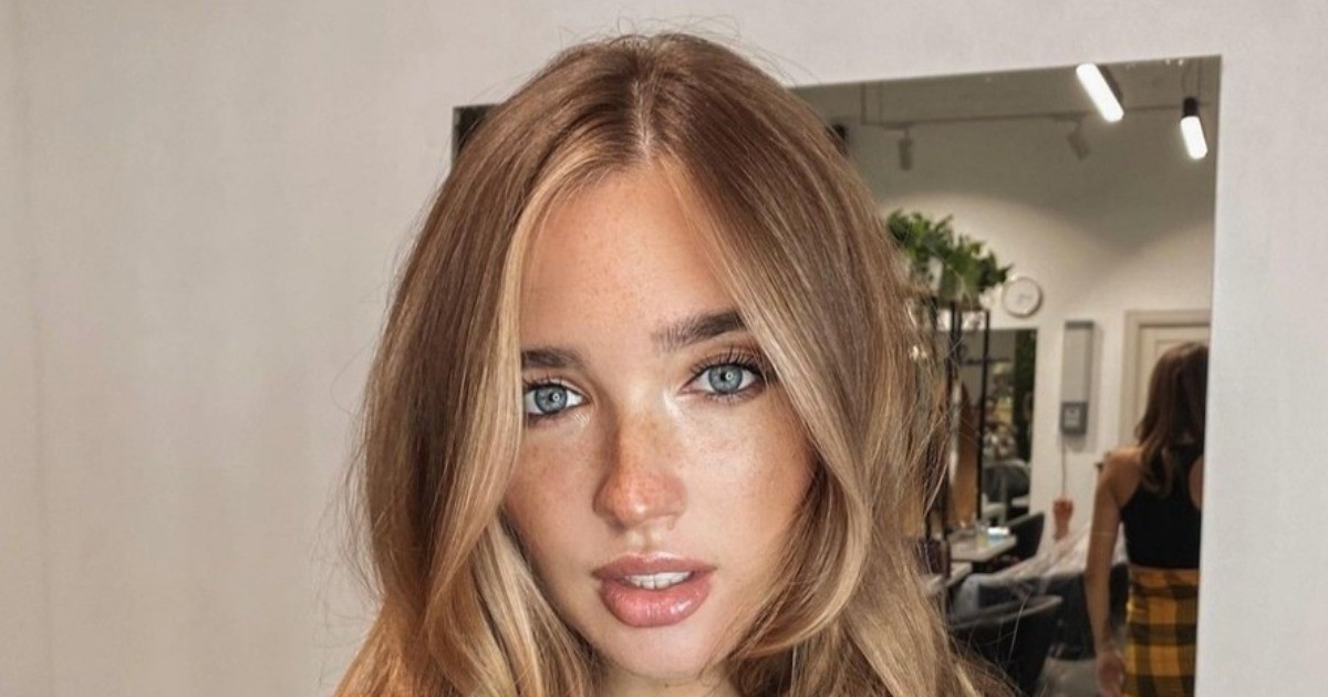 Катя Мезенова, воспитывающая сына с гигантским невусом, показала свои роды | StarHit.ru